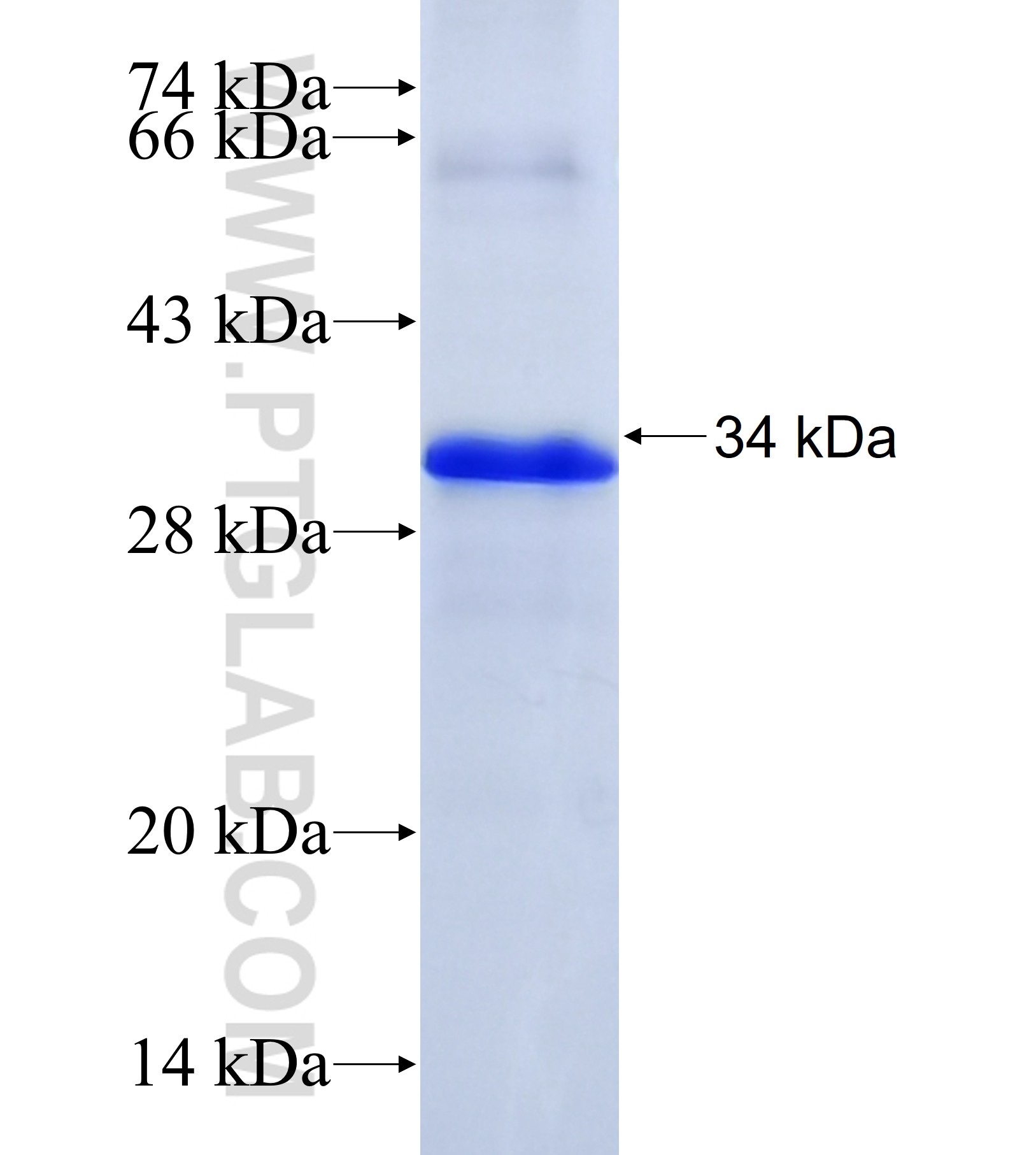 NHSL2 fusion protein Ag41045 SDS-PAGE NHSL2 fusion protein Ag41045 SDS-PAGE