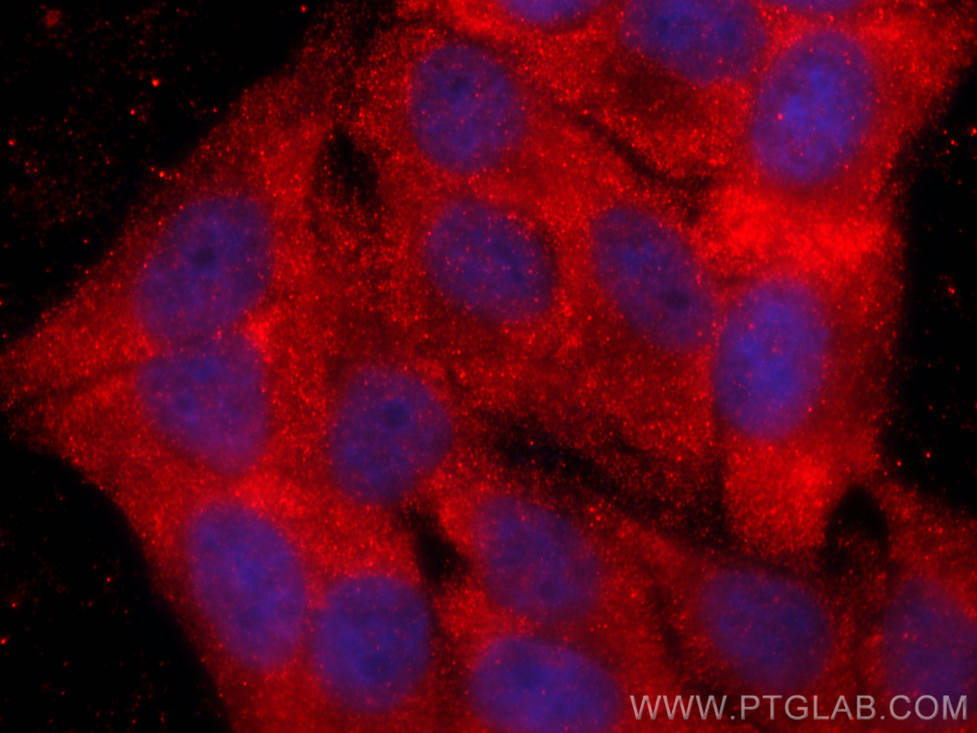 IF Staining of HepG2 using 13766-1-AP
