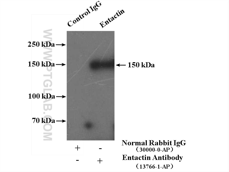 IP experiment of human placenta using 13766-1-AP