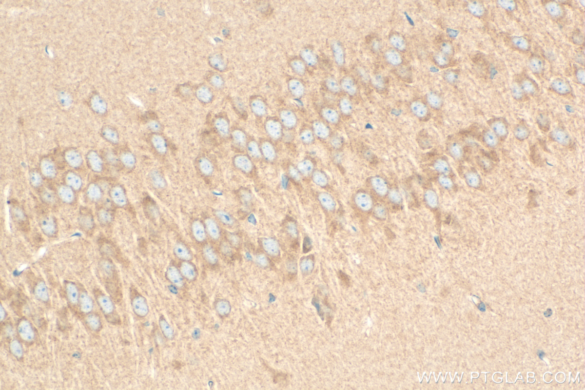 IHC staining of mouse brain using 13007-1-AP