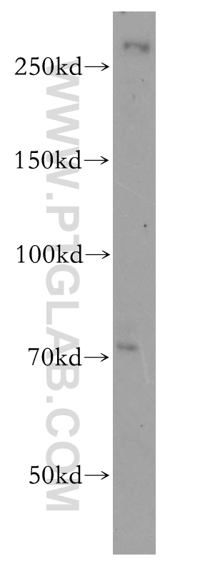 WB analysis of HeLa using 18792-1-AP