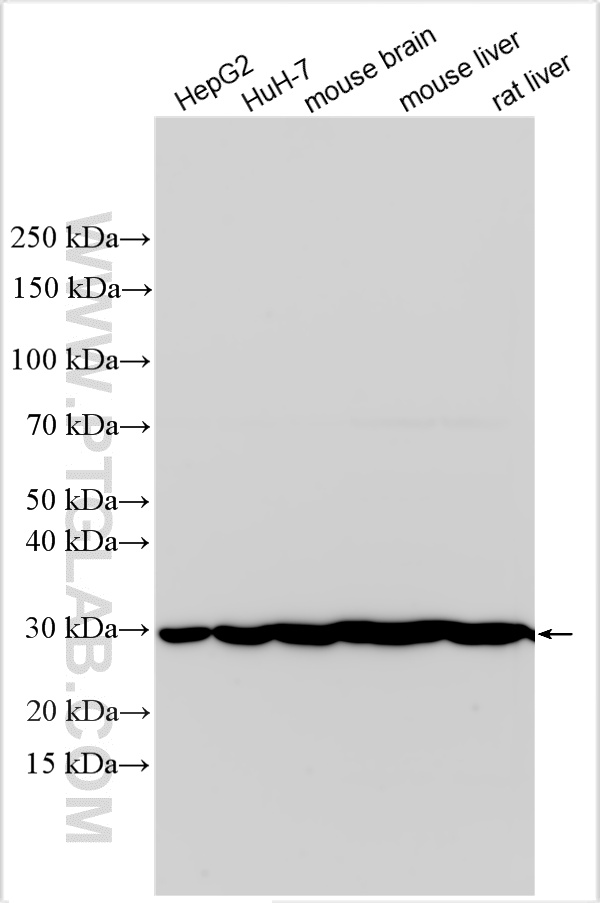 WB analysis using 33020-1-AP (same clone as 33020-1-PBS) WB analysis using 33020-1-AP (same clone as 33020-1-PBS)