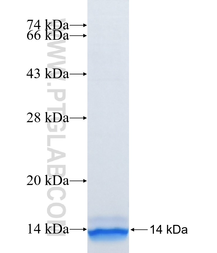 NIPSNAP1 fusion protein Ag37424 SDS-PAGE NIPSNAP1 fusion protein Ag37424 SDS-PAGE