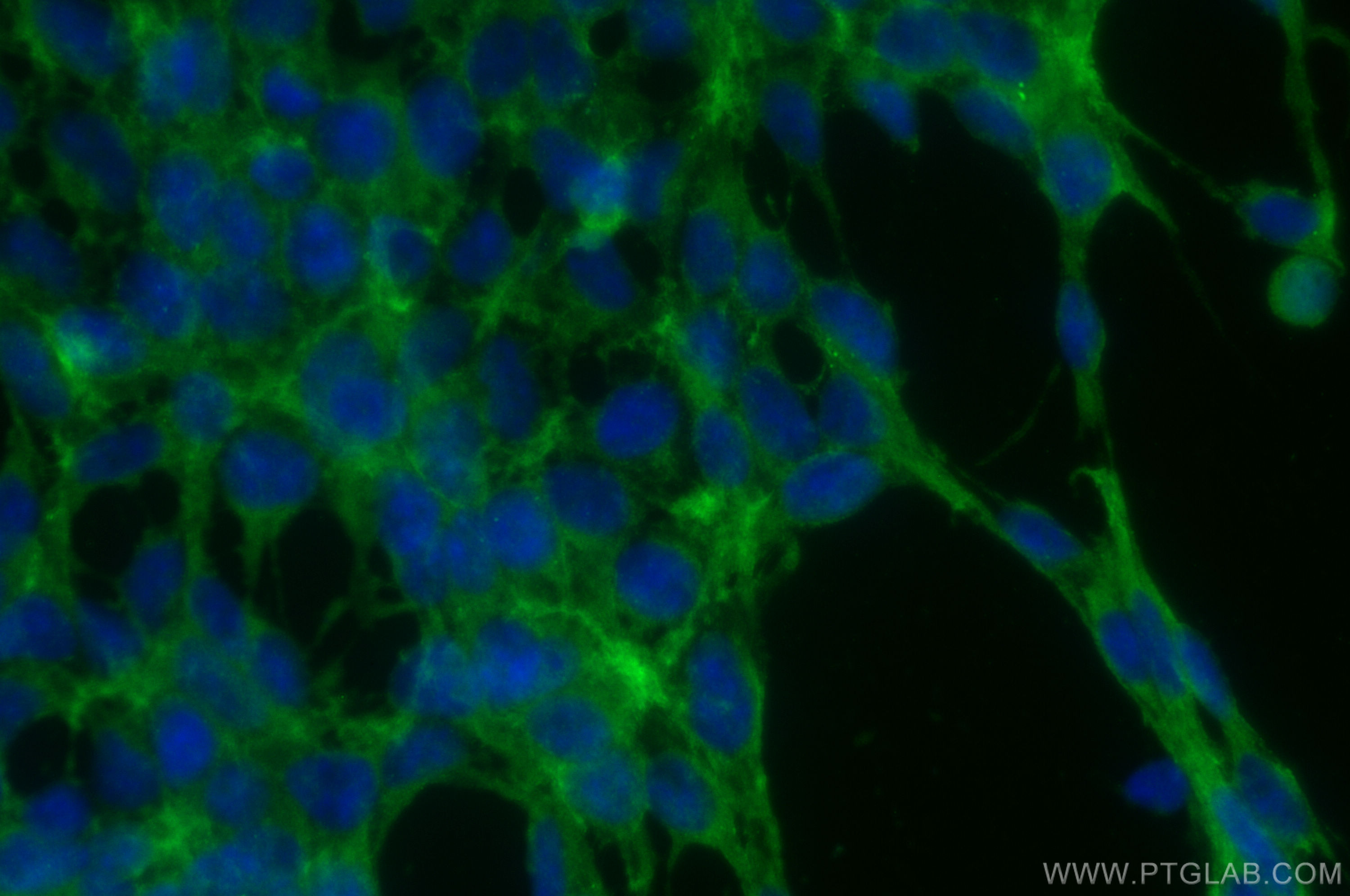 IF Staining of HEK-293 using 10751-1-AP