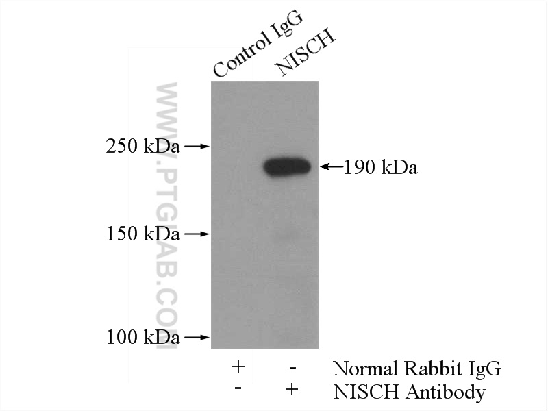 IP experiment of mouse brain using 13813-1-AP