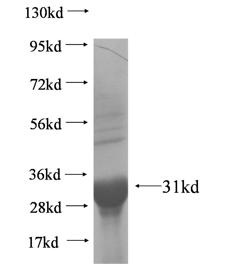 NIT1 fusion protein Ag5991 SDS-PAGE NIT1 fusion protein Ag5991 SDS-PAGE