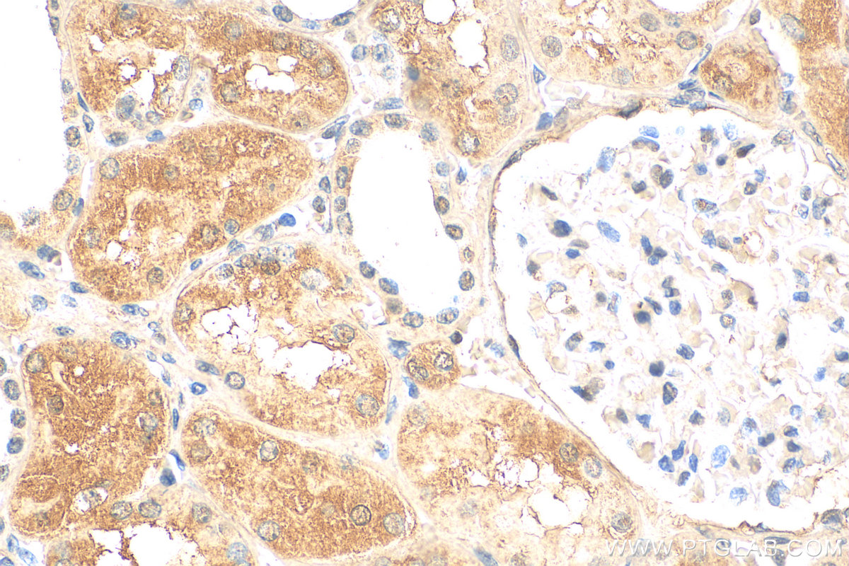 IHC staining of human kidney using 68169-1-Ig