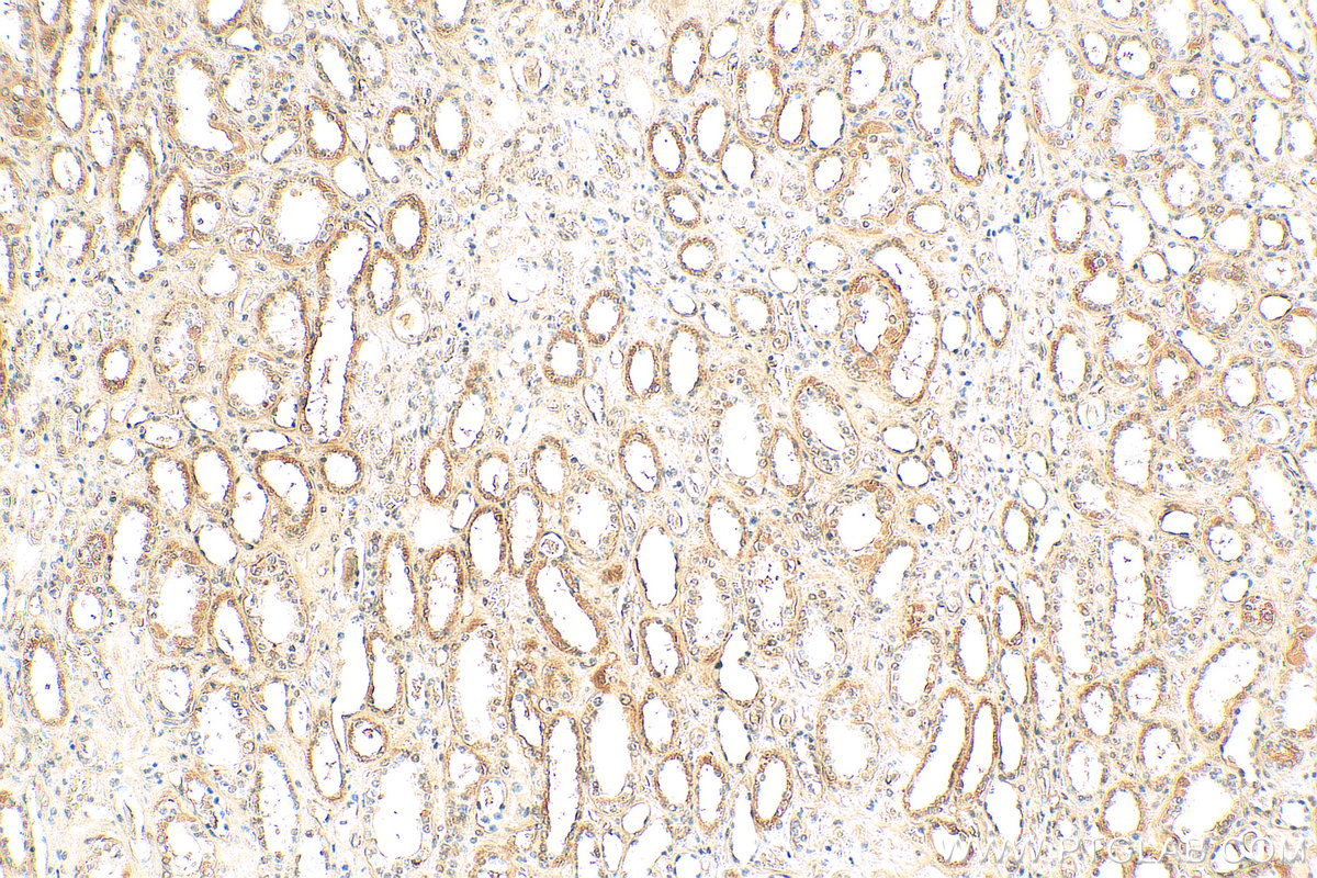 IHC staining of human kidney using 68169-1-Ig