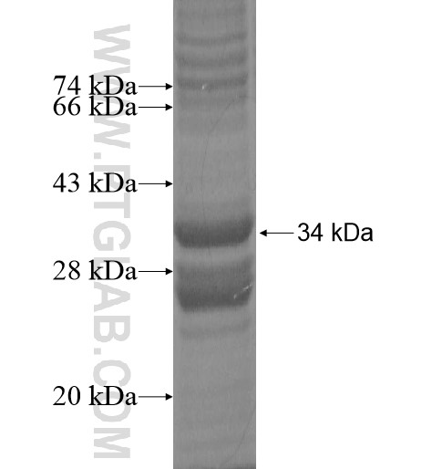 NKAIN4 fusion protein Ag14165 SDS-PAGE NKAIN4 fusion protein Ag14165 SDS-PAGE