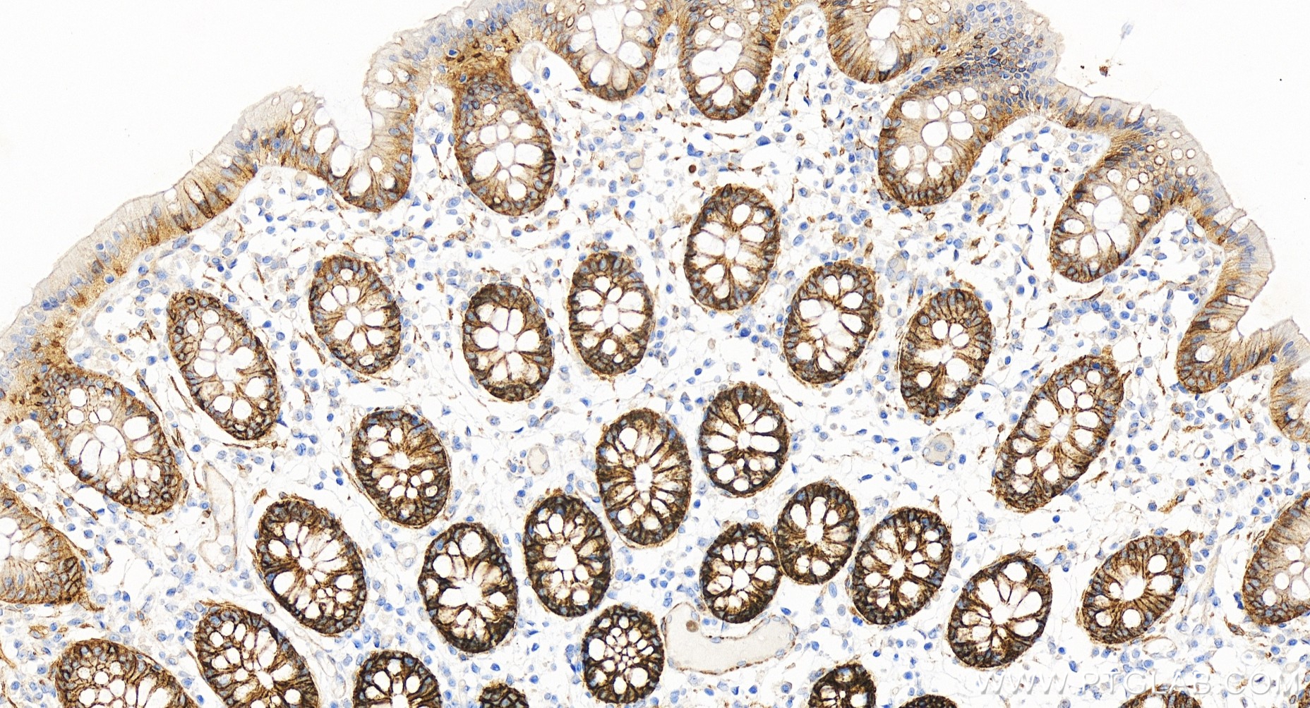 Immunohistochemical analysis of paraffin-embedded human colon tissue slide using 86201-1-RR (NKCC1/SLC12A2 antibody) at dilution of 1:500 (under 20x lens). Heat mediated antigen retrieval with Tris-EDTA buffer (pH 9.0). IHC staining of human colon using 86201-1-RR