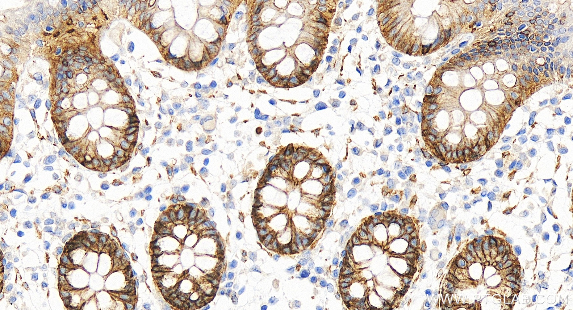 Immunohistochemical analysis of paraffin-embedded human colon tissue slide using 86201-1-RR (NKCC1/SLC12A2 antibody) at dilution of 1:500 (under 40x lens). Heat mediated antigen retrieval with Tris-EDTA buffer (pH 9.0). IHC staining of human colon using 86201-1-RR