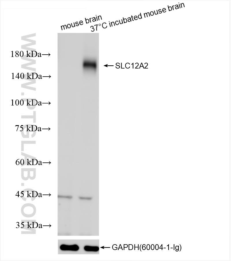 Various lysates were subjected to SDS PAGE followed by western blot with 86201-1-RR (NKCC1/SLC12A2 antibody) at dilution of 1:2000 incubated at room temperature for 1.5 hours. WB analysis using 86201-1-RR