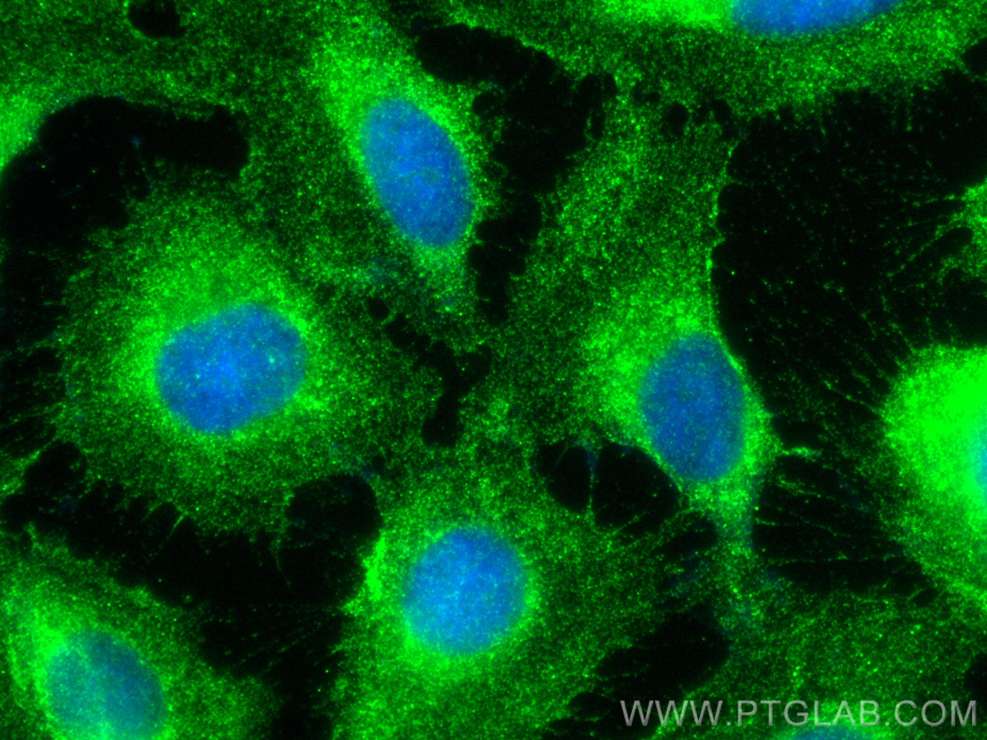 IF Staining of U2OS using CL488-28055