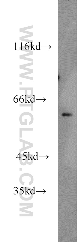 WB analysis of mouse kidney using 16699-1-AP