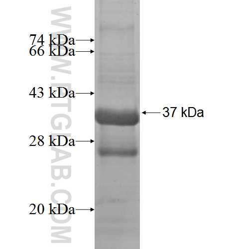 NKG7 fusion protein Ag2117 SDS-PAGE