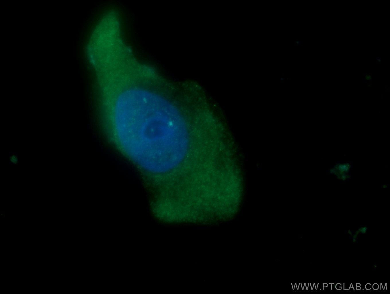 IF Staining of A431 using 10174-1-AP