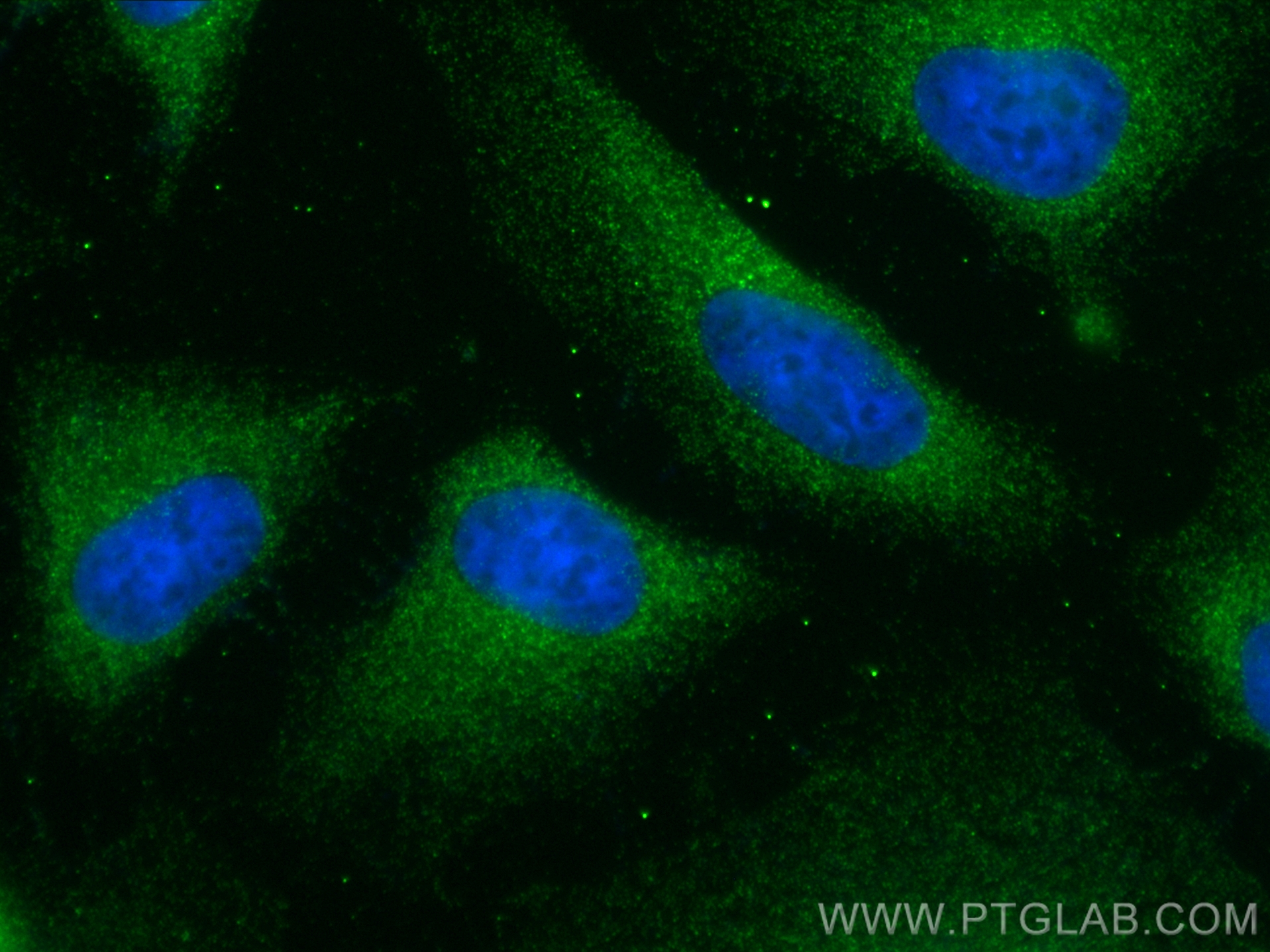 IF Staining of HeLa using 10174-1-AP