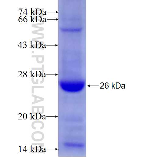NKPD1 fusion protein Ag27667 SDS-PAGE NKPD1 fusion protein Ag27667 SDS-PAGE