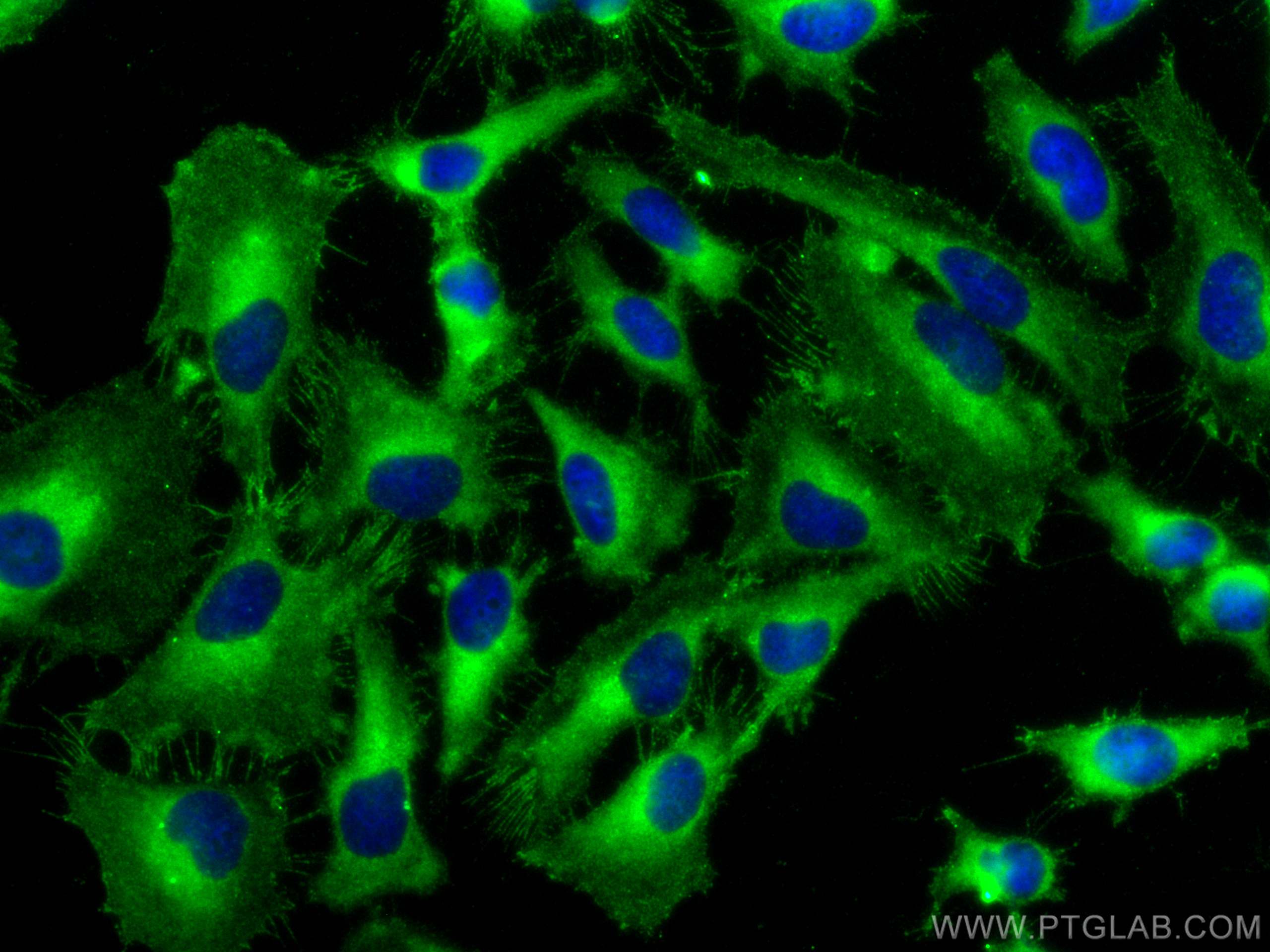 IF Staining of HeLa using 19978-1-AP