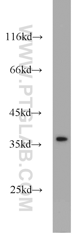 WB analysis of HeLa using 21777-1-AP