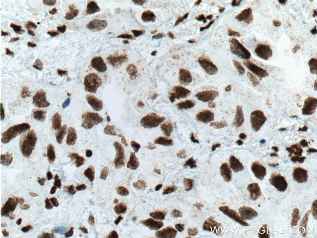 TTF1 Monoclonal antibody