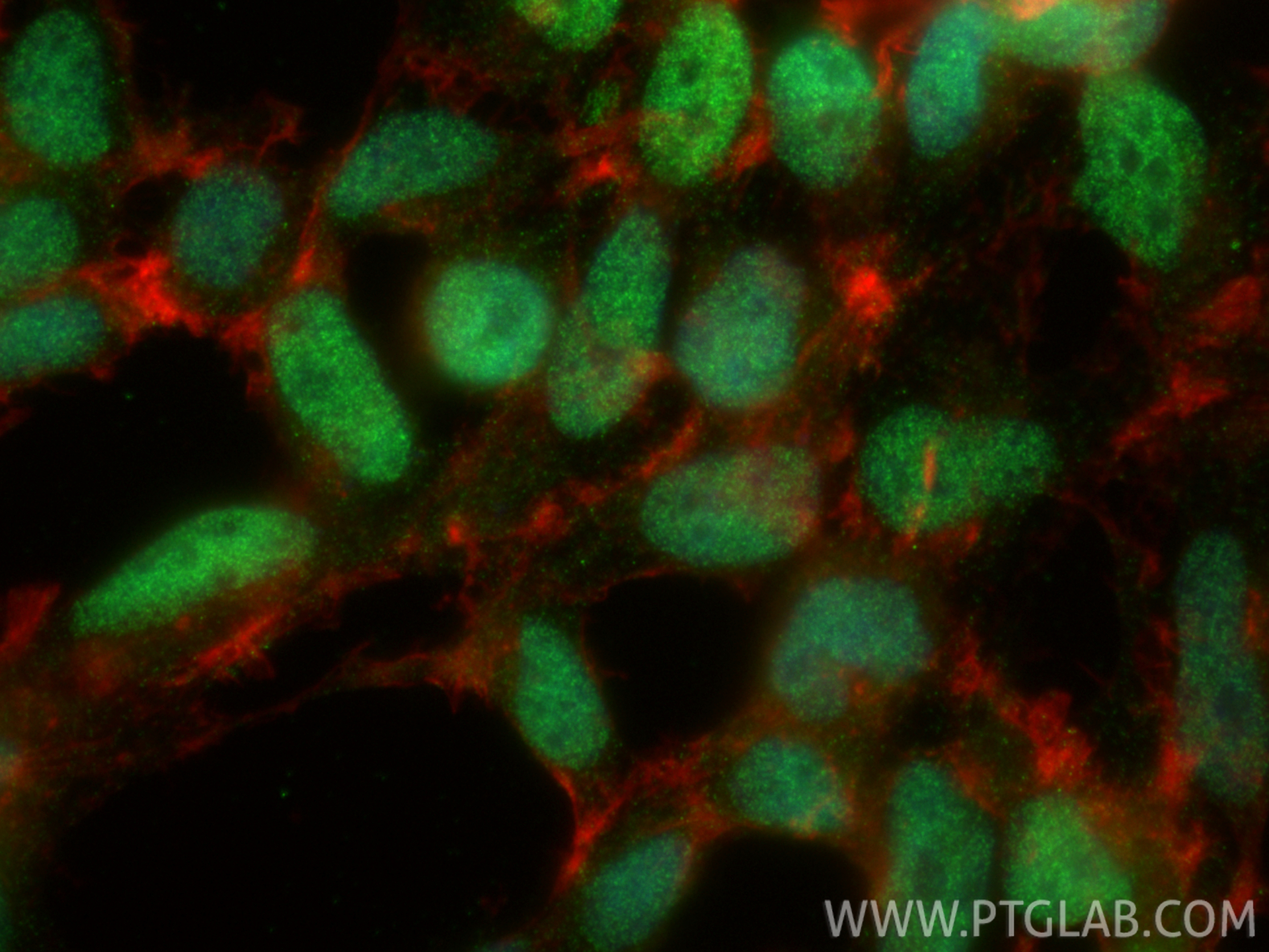 IF Staining of HEK-293 using 33052-1-AP (same clone as 33052-1-PBS)