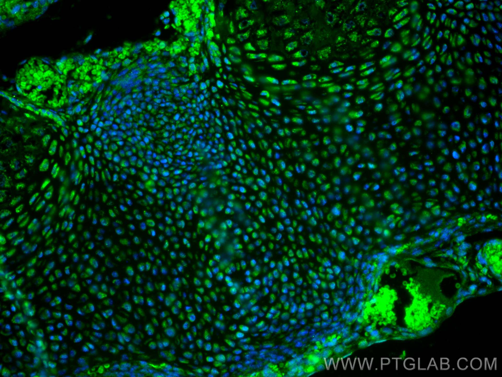 IF Staining of mouse embryo using 13921-1-AP (same clone as 13921-1-PBS)