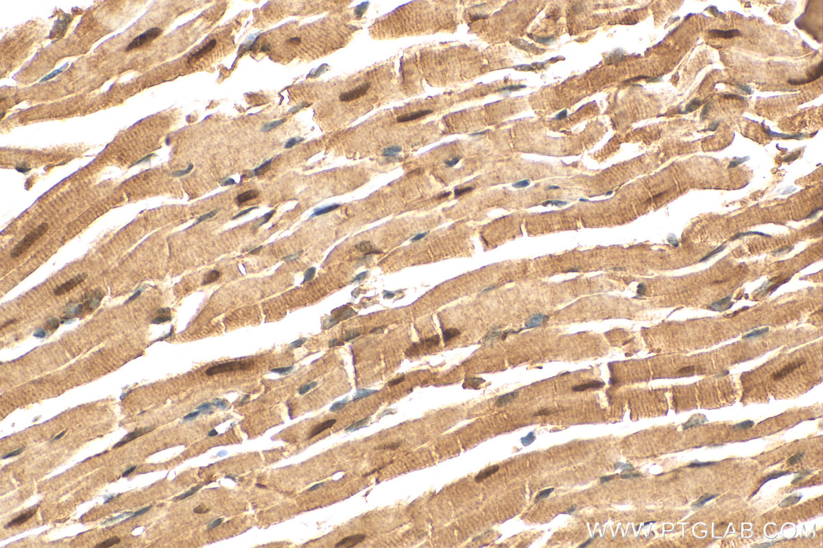 IHC staining of mouse heart using 13921-1-AP (same clone as 13921-1-PBS)