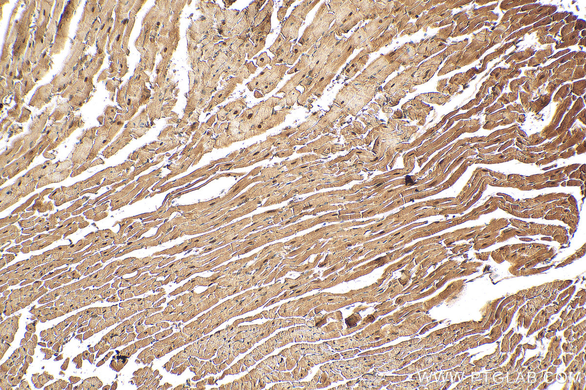 IHC staining of mouse heart using 13921-1-AP (same clone as 13921-1-PBS)
