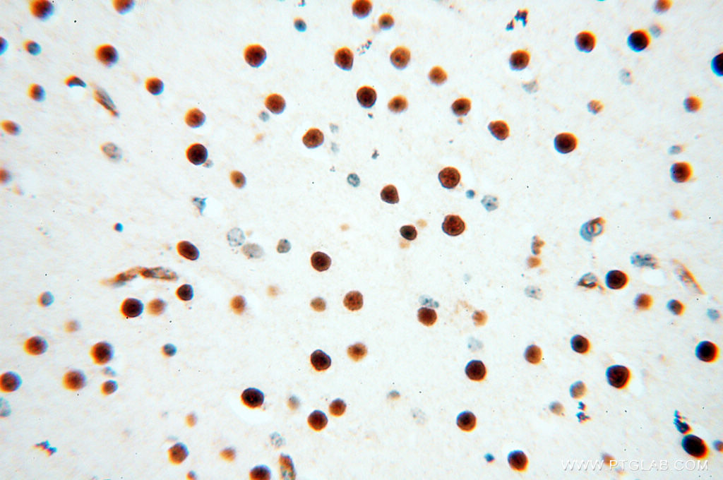 IHC staining of human brain using 13921-1-AP (same clone as 13921-1-PBS)