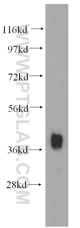 WB analysis of human heart using 13921-1-AP