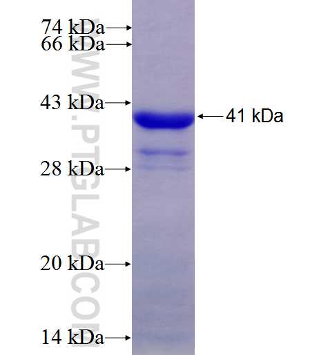 NKX2-5 fusion protein Ag5534 SDS-PAGE NKX2-5 fusion protein Ag5534 SDS-PAGE
