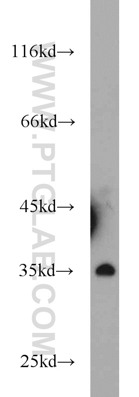 WB analysis of human testis using 13069-1-AP