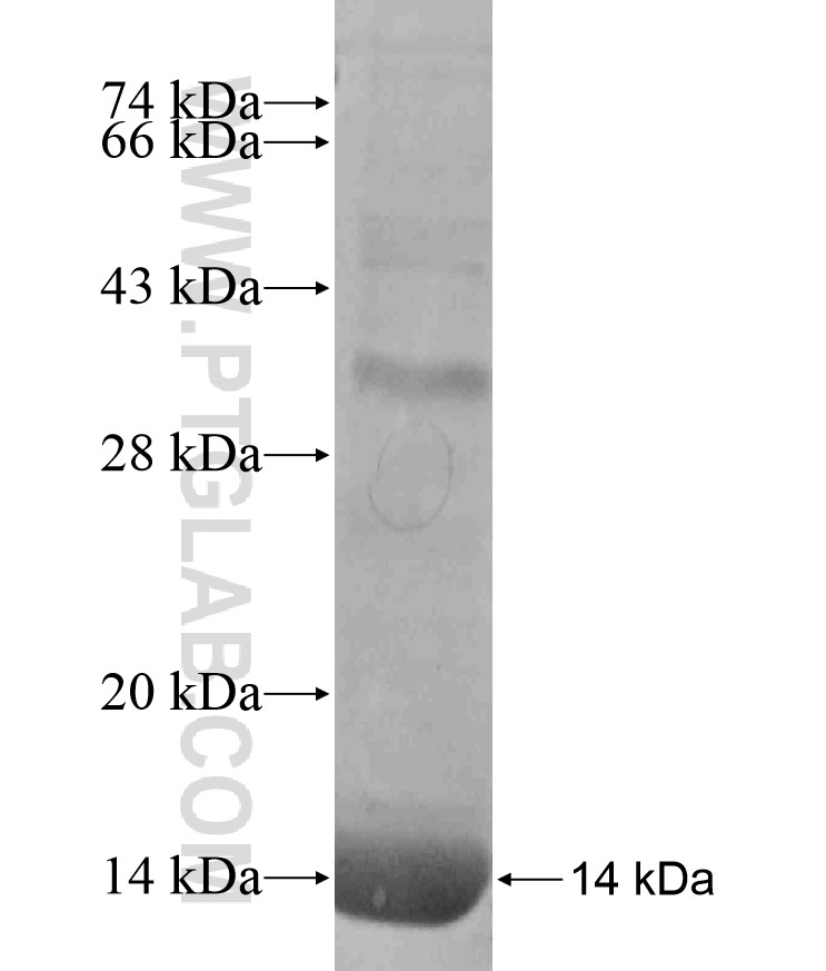 NKX3-1 fusion protein Ag17640 SDS-PAGE NKX3-1 fusion protein Ag17640 SDS-PAGE