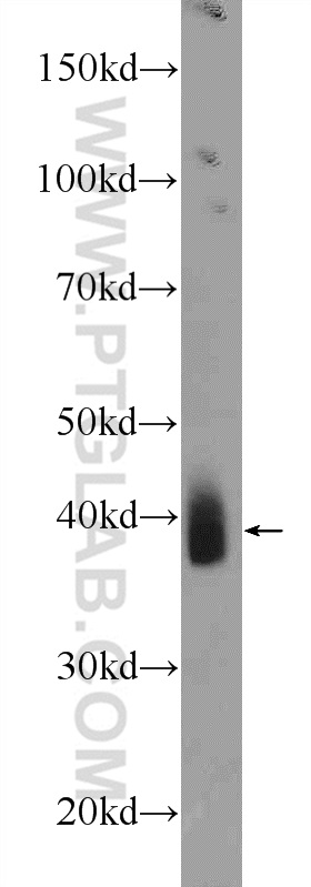 WB analysis of mouse skeletal muscle using 22491-1-AP