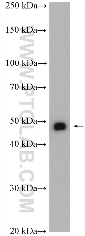 WB analysis of mouse brain using 20974-1-AP