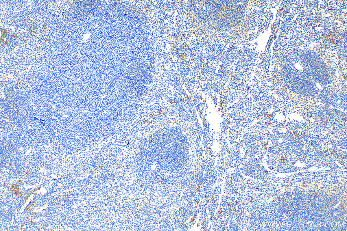 IHC staining of mouse spleen using 31984-1-AP