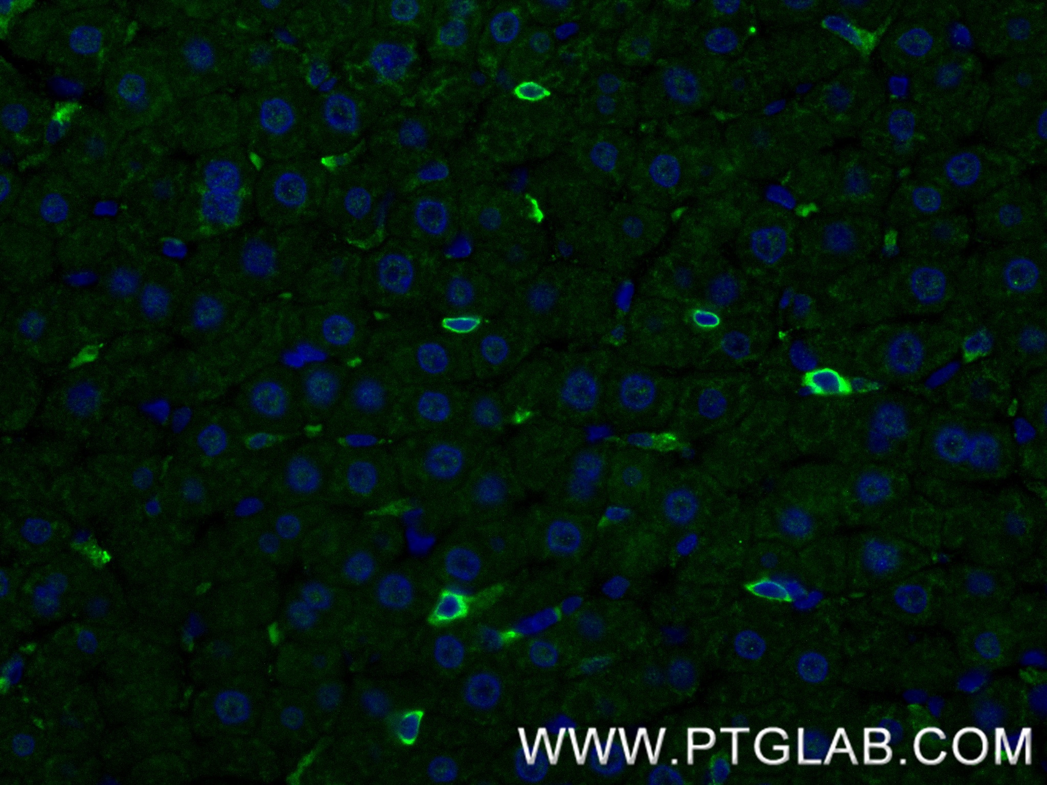 IF Staining of rat spleen using 84416-5-RR