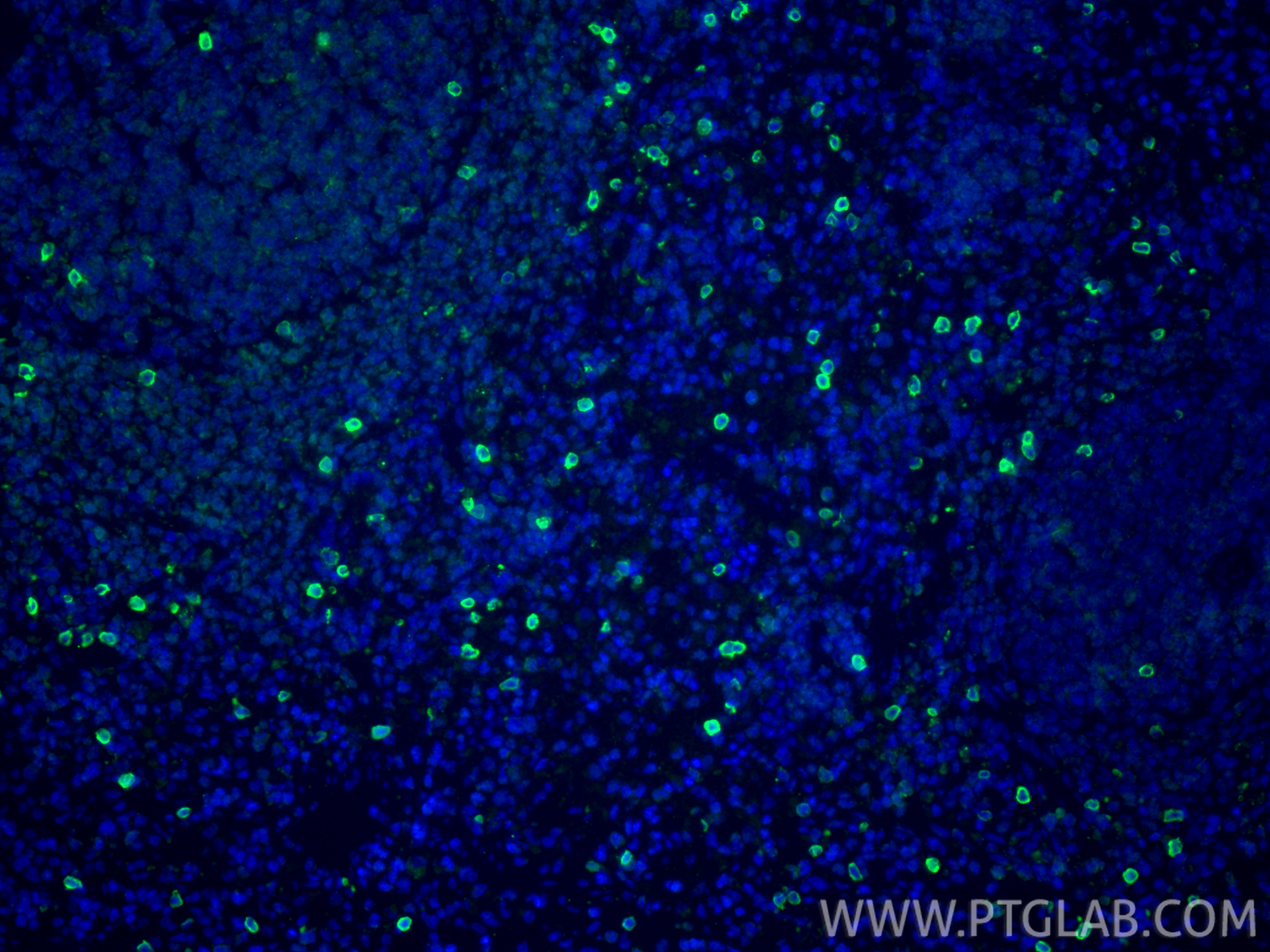 IF Staining of rat spleen using 84416-5-RR