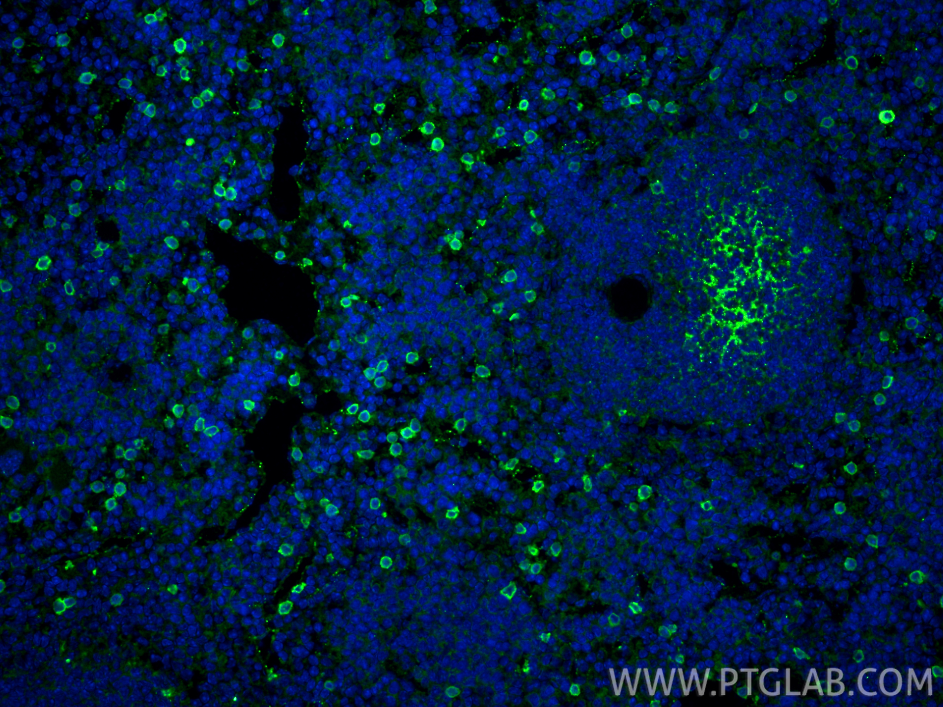 IF Staining of mouse spleen using 84416-5-RR