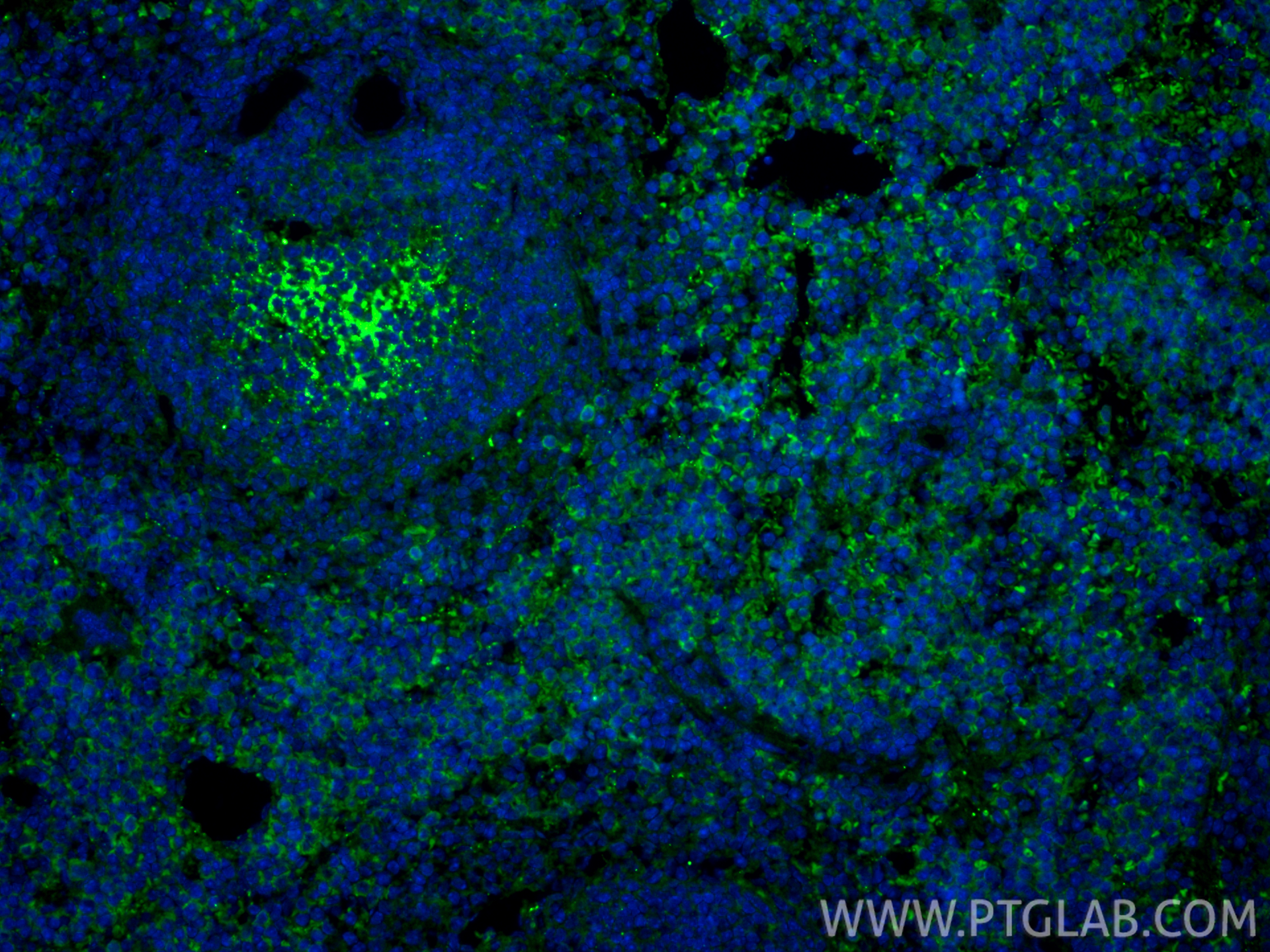 Immunofluorescent analysis of (4% PFA) fixed paraffin-embedded mouse spleen tissue using CoraLite® Plus 488 NKp46/NCR1 antibody (CL488-84416-5, Clone: 241811H7 ) at dilution of 1:200. Heat mediated antigen retrieval with Tris-EDTA buffer (pH 9.0). IF Staining of mouse spleen using CL488-84416-5