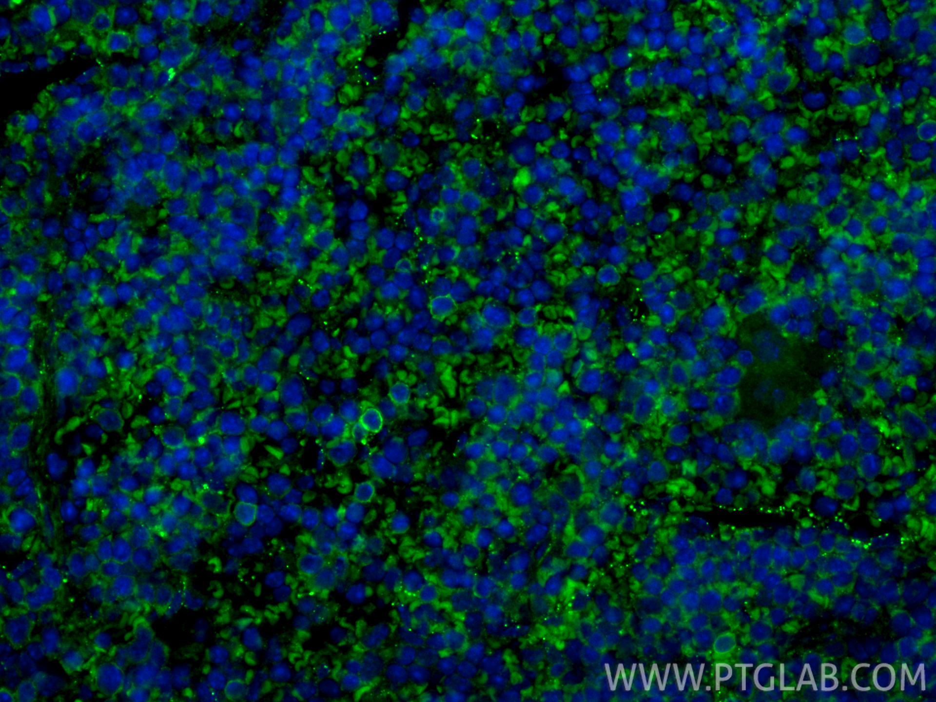 Immunofluorescent analysis of (4% PFA) fixed paraffin-embedded mouse spleen tissue using CoraLite® Plus 488 NKp46/NCR1 antibody (CL488-84416-5, Clone: 241811H7 ) at dilution of 1:200. Heat mediated antigen retrieval with Tris-EDTA buffer (pH 9.0). IF Staining of mouse spleen using CL488-84416-5
