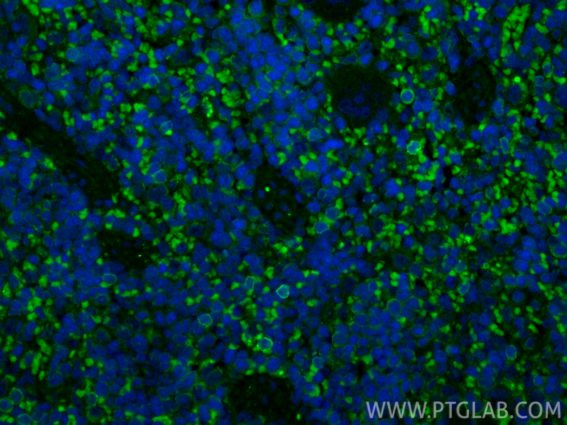 Immunofluorescent analysis of (4% PFA) fixed paraffin-embedded rat spleen tissue using CoraLite® Plus 488 NKp46/NCR1 antibody (CL488-84416-5, Clone: 241811H7 ) at dilution of 1:200. Heat mediated antigen retrieval with Tris-EDTA buffer (pH 9.0). IF Staining of rat spleen using CL488-84416-5