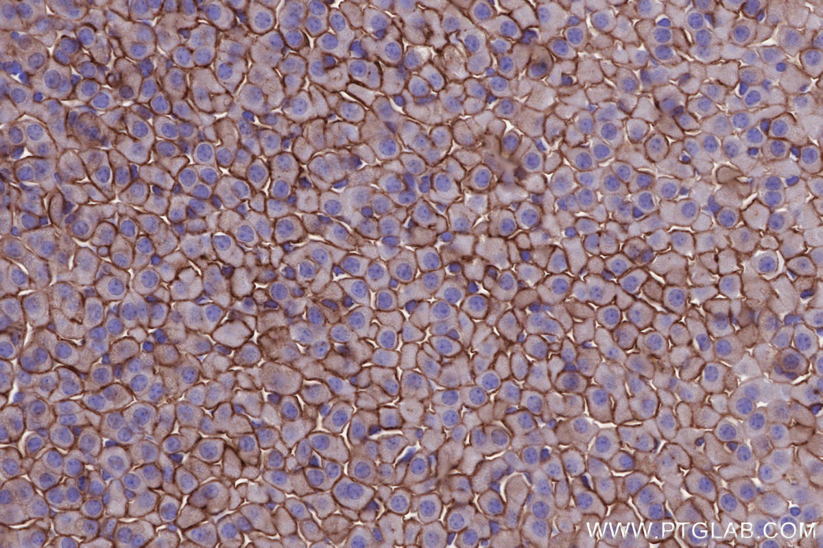 IHC staining of mouse adrenal gland using 66964-1-Ig IHC staining of mouse adrenal gland using 66964-1-Ig