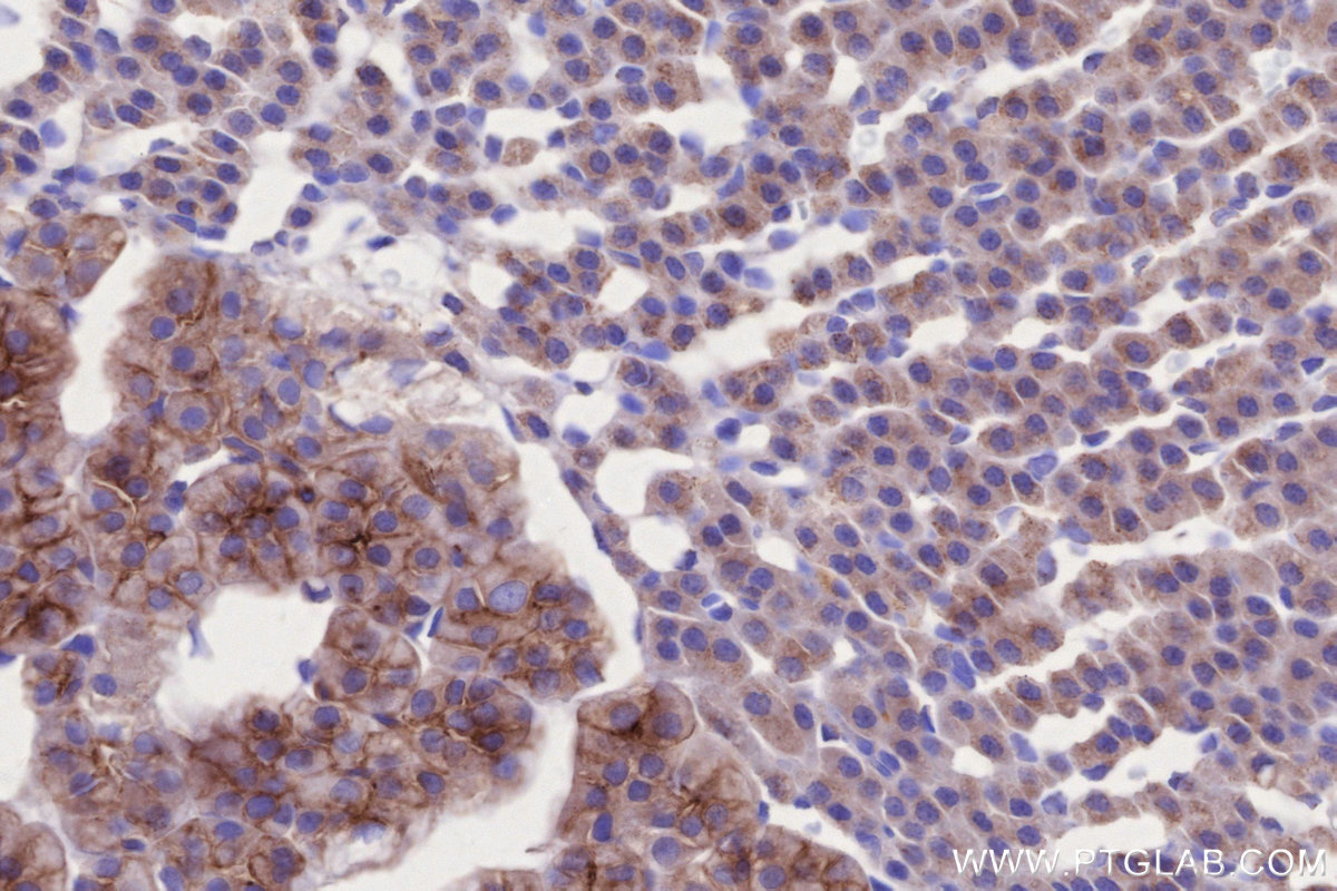 IHC staining of rat adrenal gland using 66964-1-Ig IHC staining of rat adrenal gland using 66964-1-Ig