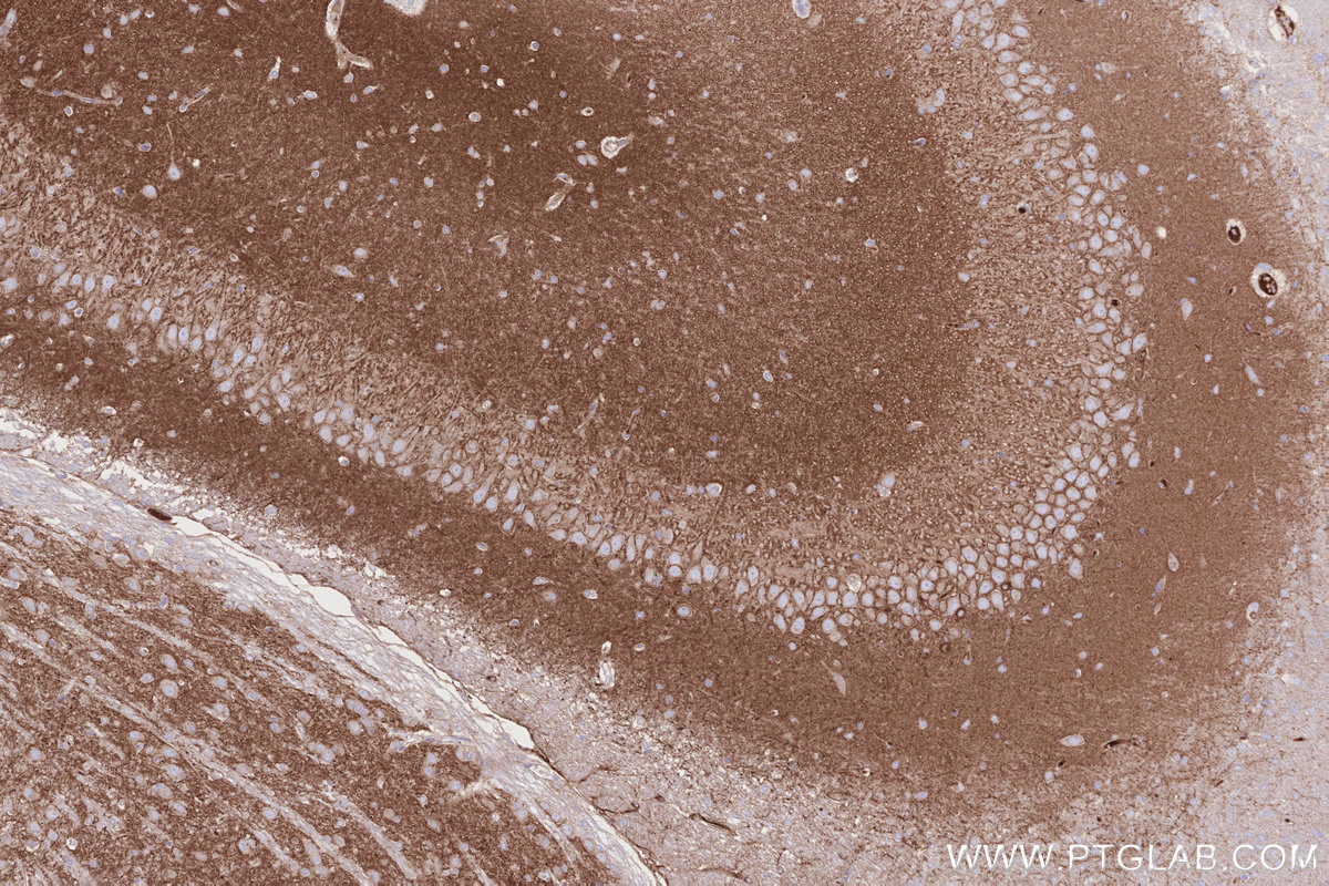 IHC staining of rat brain using 66964-1-Ig IHC staining of rat brain using 66964-1-Ig