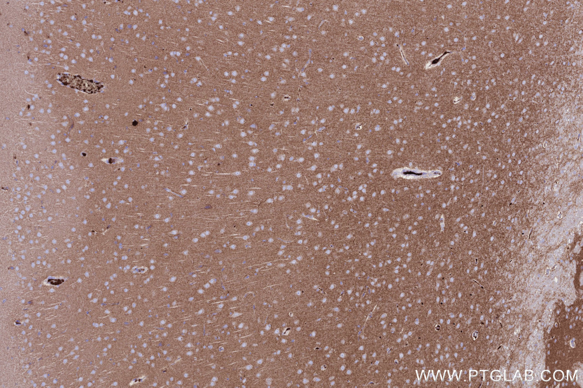 IHC staining of rat brain using 66964-1-Ig IHC staining of rat brain using 66964-1-Ig