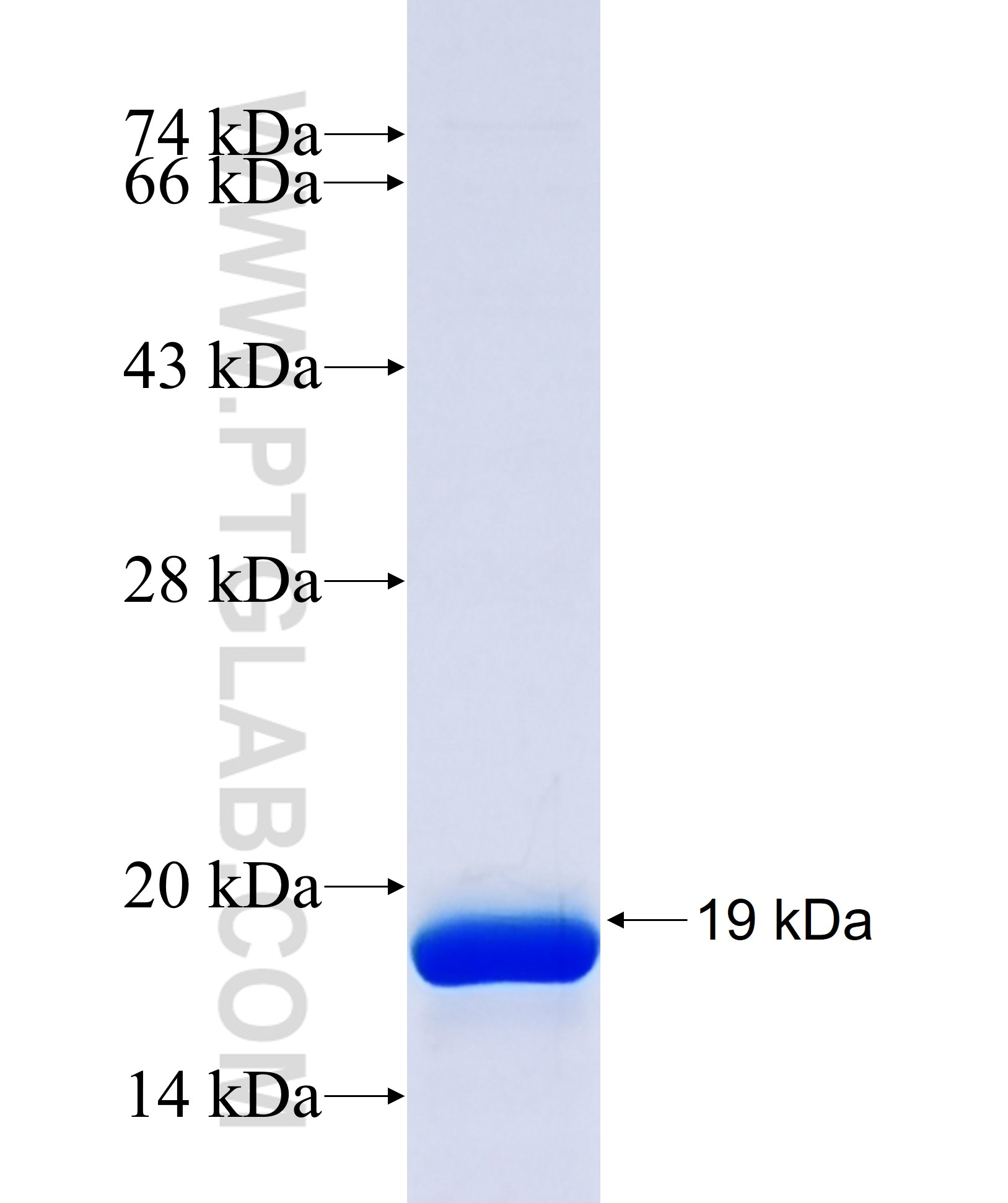 NLGN3 fusion protein Ag30493 SDS-PAGE NLGN3 fusion protein Ag30493 SDS-PAGE