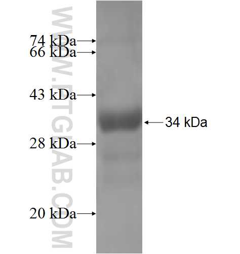 NLGN4Y fusion protein Ag4633 SDS-PAGE NLGN4Y fusion protein Ag4633 SDS-PAGE
