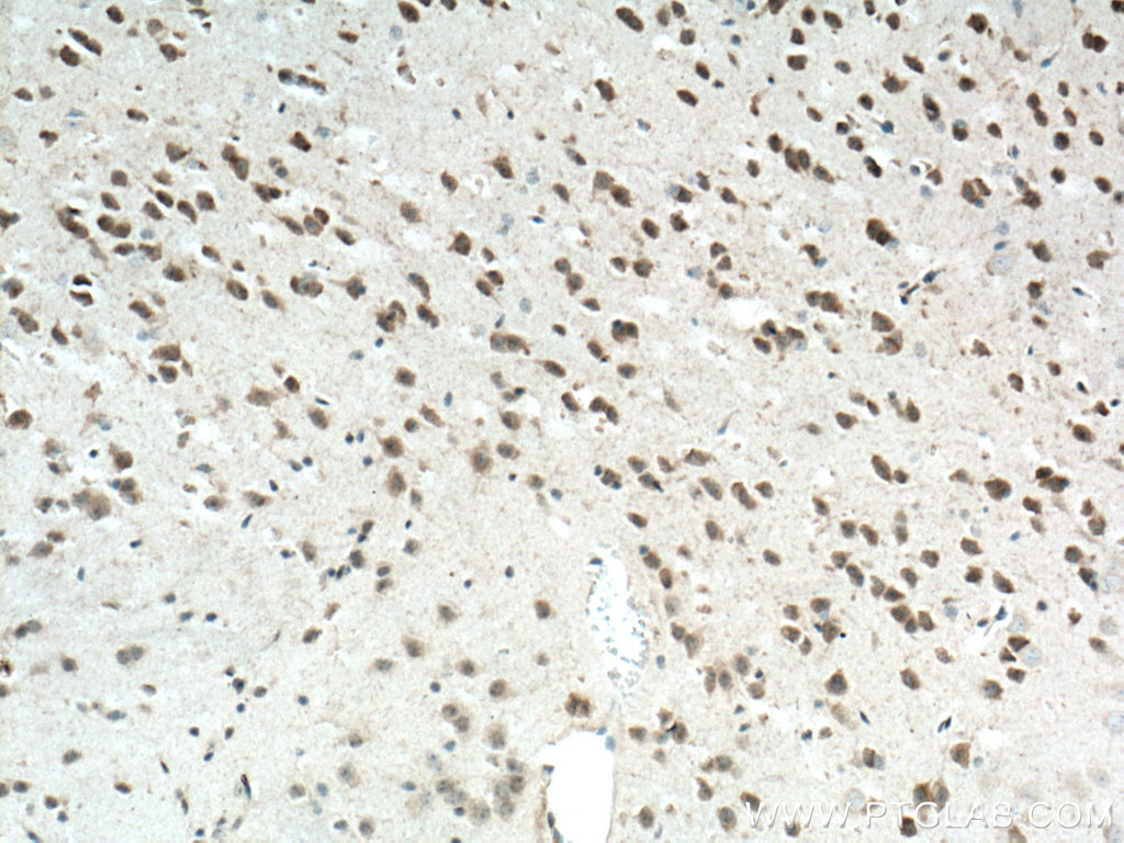 IHC staining of mouse brain using 12256-1-AP